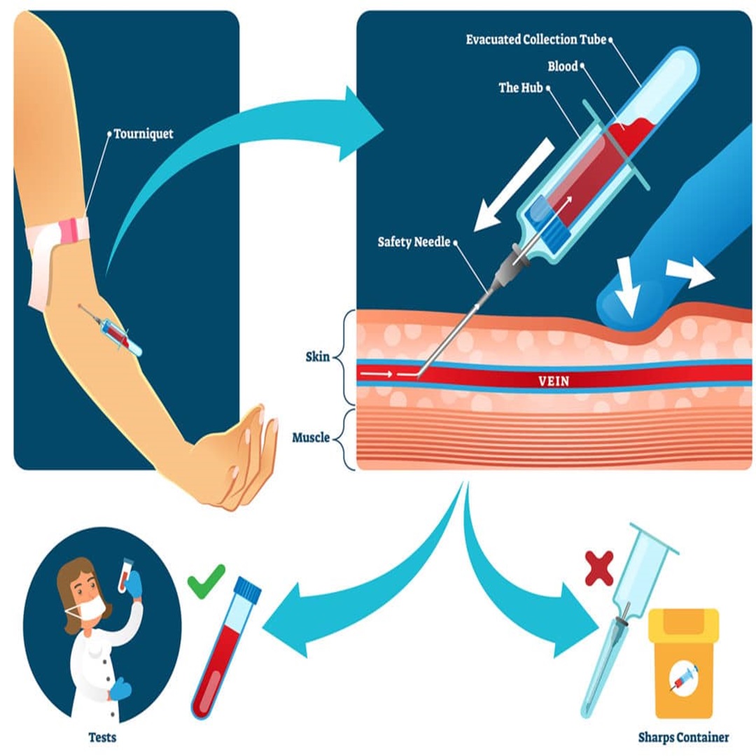 How to Choose the Right Blood Collection Tube for Different Medical Tests